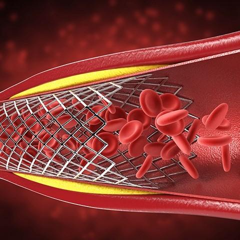 Best Doctors for Angiogram in Hyderabad