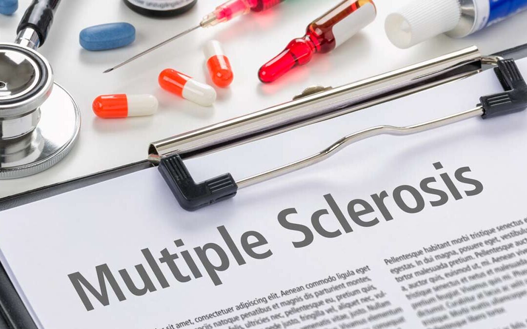 Multiple Sclerosis And Cardiovascular Diseases: Expert Explains The Connection Between The Two