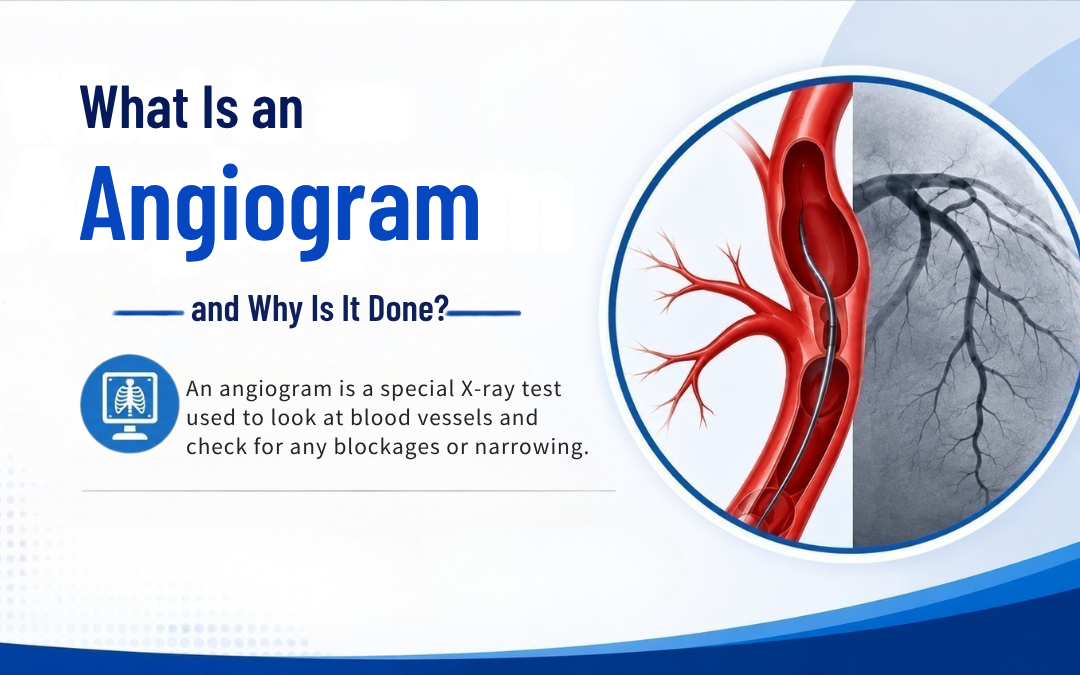 What Is an Angiogram and Why Is It Done?