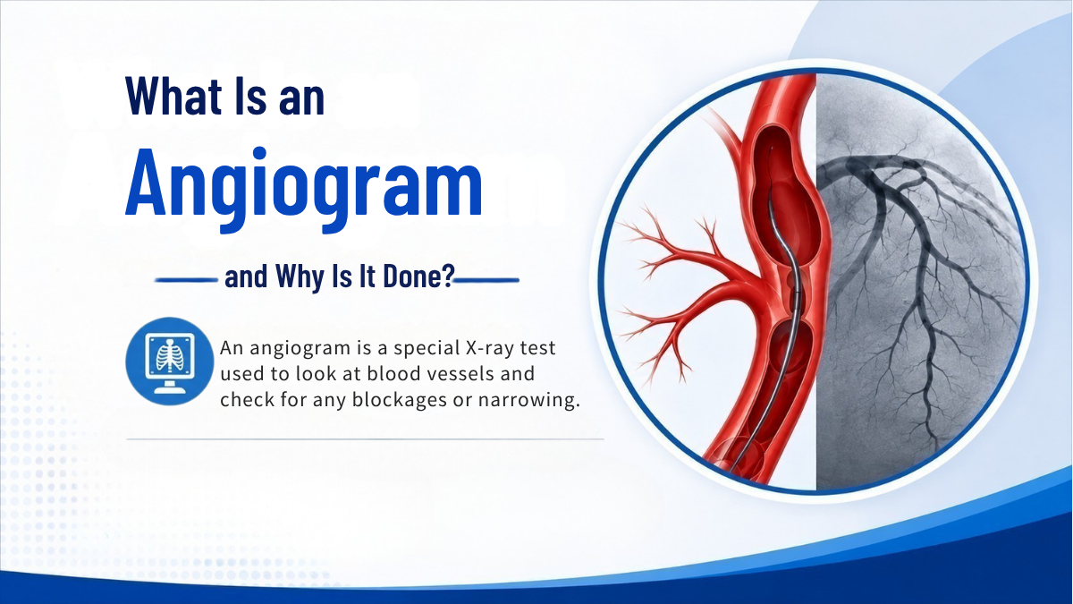 What Is an Angiogram and Why Is It Done?