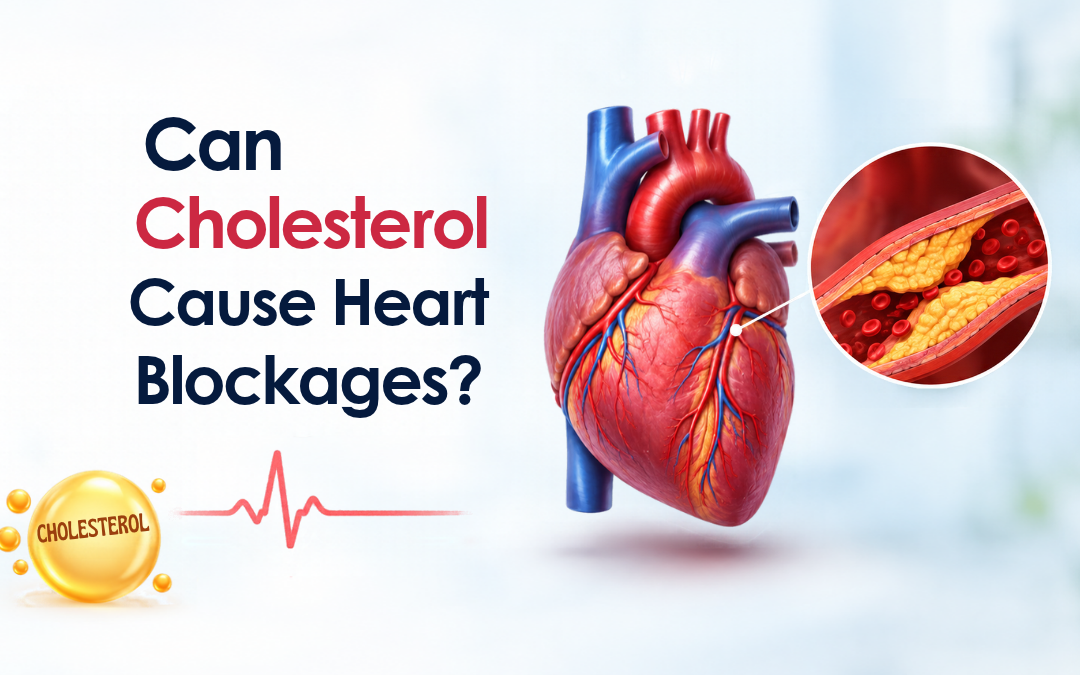 Can Cholesterol Cause Heart Blockages?