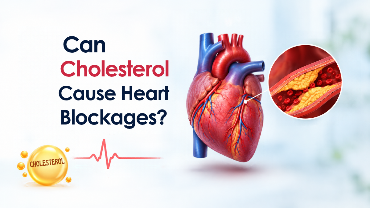 Can Cholesterol Cause Heart Blockages?